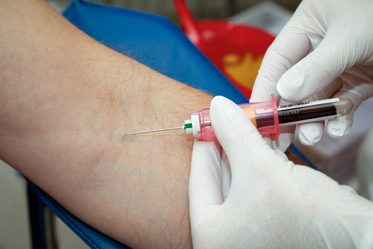 Les marqueurs dans une prise de sang : comment peuvent-ils révéler des maladies cachées ?